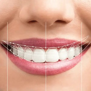 best dentist in miami,porcelain veneers miami,Botox miami,root canal cost miami,sinus lift miami,best veneers miami,best dentist south florida,best cosmetic dentist miami,best dental care miami,sage dental