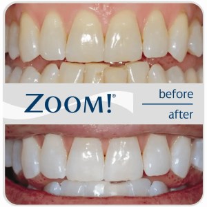 best dentist in miami,porcelain veneers miami,Botox miami,root canal cost miami,sinus lift miami,best veneers miami,best dentist south florida,best cosmetic dentist miami,best dental care miami,sage dental